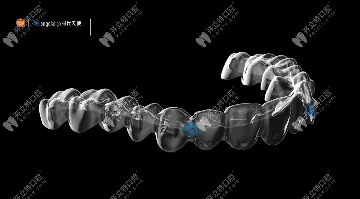 時代天使隱形牙套圖示