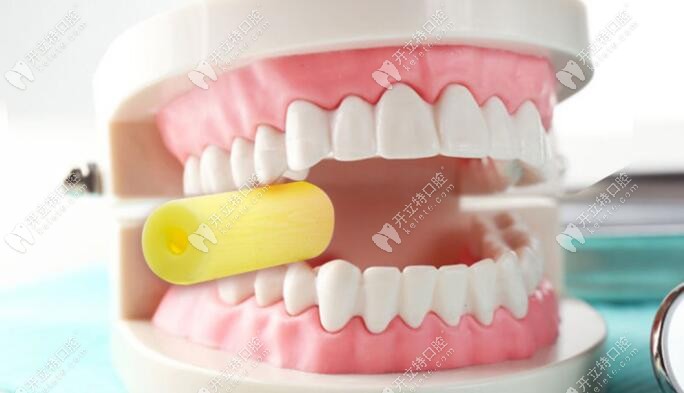 透明牙套咬膠的作用