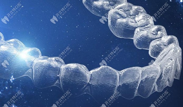 vvsmile隱形矯正器價(jià)格