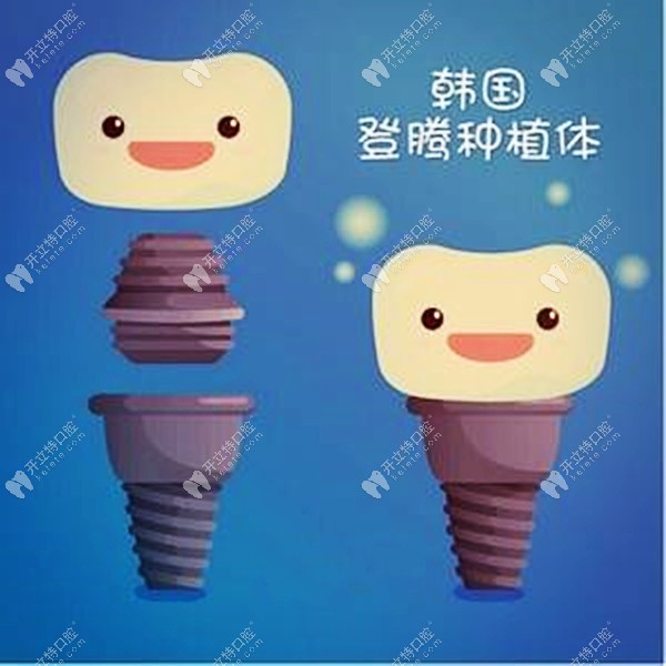 昆明做韓國純鈦登騰種植牙補貼價2399元一顆，也太便宜了吧