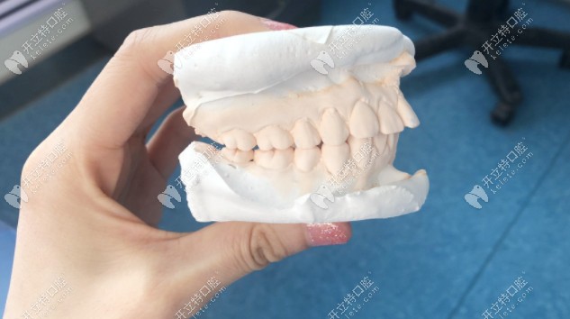 我從天包地到美牙,戴美國(guó)奧美科自鎖矯正的這一年經(jīng)歷了啥