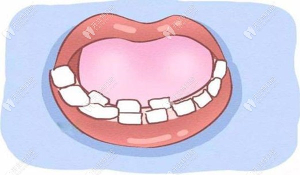 孩子長(zhǎng)雙排牙是什么原因?qū)е碌哪?什么時(shí)候拔除比較好?