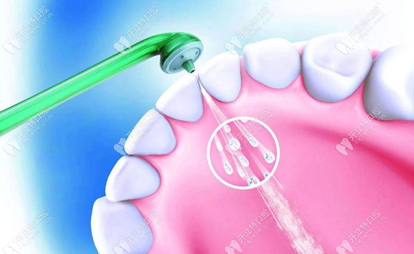 皓得適與皓齒美白的區(qū)別是什么