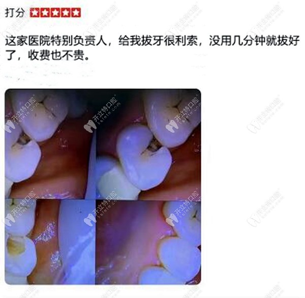 拔牙顧客評價藍(lán)天口腔