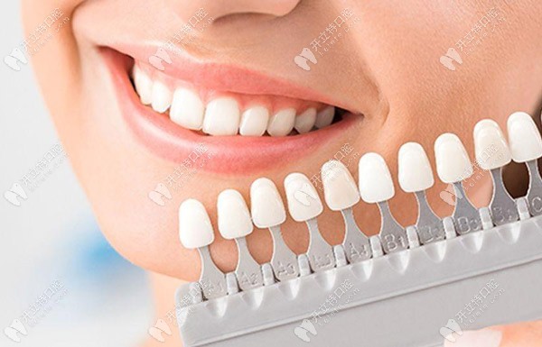 明星同款的皓得適牙齒美白+超聲波潔牙價格僅需880元起