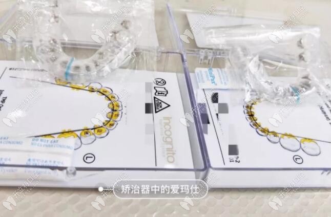 3m黃金incognito舌側隱形矯正價格一般是多少？講講它的優(yōu)缺點