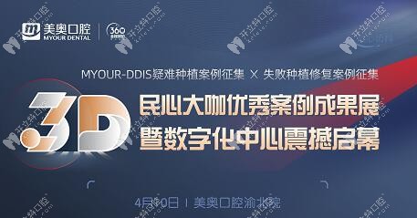 聽說(shuō)美奧口腔做精準(zhǔn)種植牙還不受罪,這場(chǎng)案例直播不能錯(cuò)過(guò)