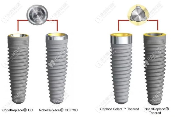 大眾口腔瑞典N(xiāo)obel種植系統(tǒng)型號(hào)