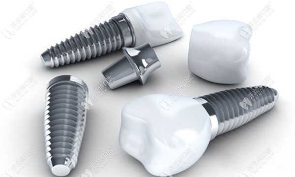 美國皓圣種植牙收費標準