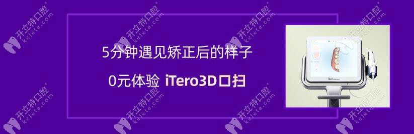 0元體驗(yàn)itero3D口掃