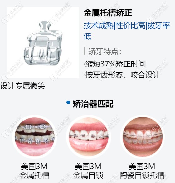 曙光口腔做金屬托槽矯正不同的矯治器