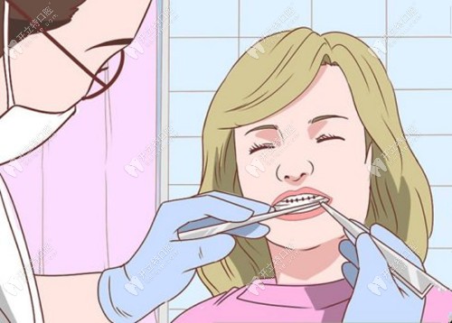 楊醫(yī)生粘托槽的時候十分認(rèn)真