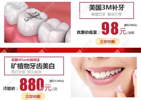 廣州廣大口腔美國3m補(bǔ)牙首顆優(yōu)惠