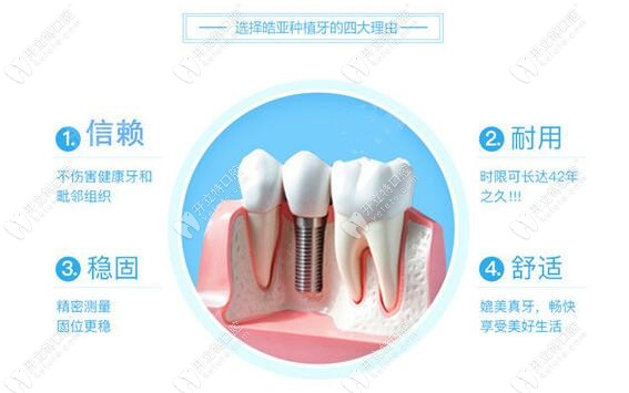 HIOSSEN皓圣種植系統(tǒng)的4大優(yōu)勢