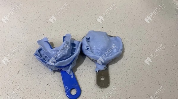 制作的牙模圖示