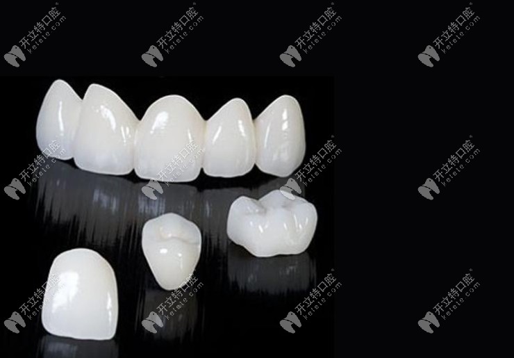美國(guó)進(jìn)口全瓷牙透光性特別好