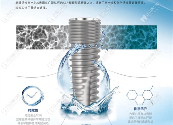 康盛植體均為骨水平設(shè)計(jì)