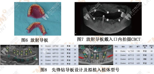 采取的治療計(jì)劃