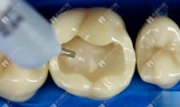 樹脂材料粘接力比較強(qiáng)