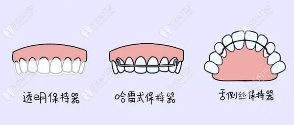 常見(jiàn)保持器類型