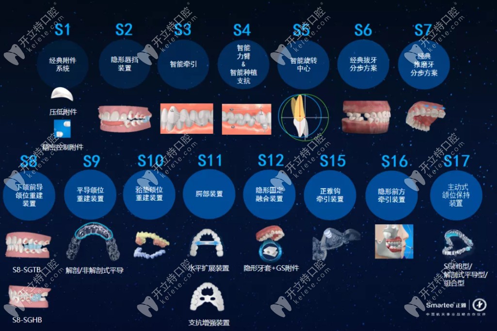 恭?！墩胖鲃有皖M位保持器S17》新款亮相