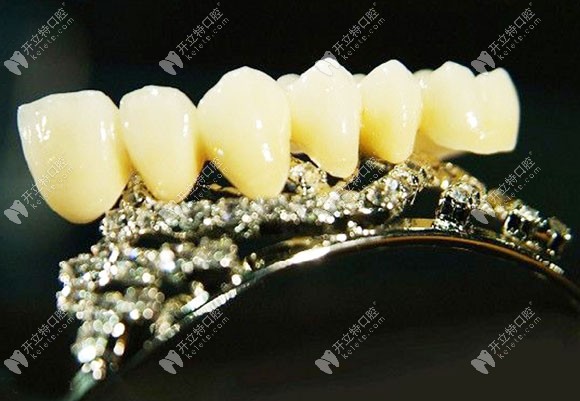 廣州做進(jìn)口二氧化鋯全烤瓷牙冠多少錢一顆的答案,請(qǐng)收好!