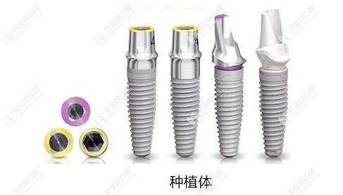 分享沈陽盛大口腔價格表，盛大做種植牙口碑好價格還不貴