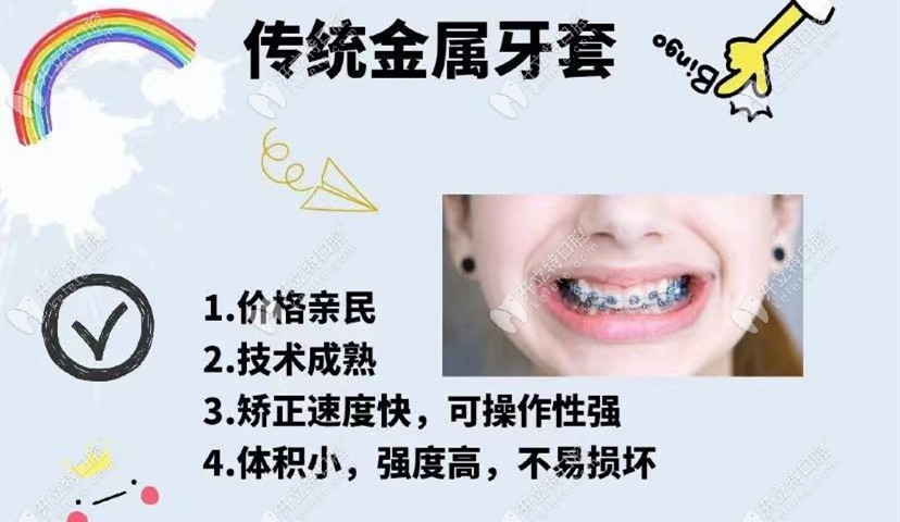 鋼牙套優(yōu)點