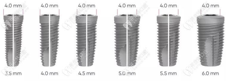 neoss種植牙型號(hào)