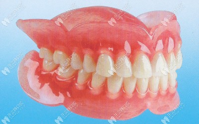 活動(dòng)假牙外觀