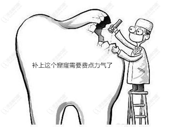 想找秦皇島瑞格口腔補牙材料的價格？這家收費便宜效果好