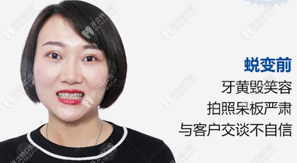 牙黃毀笑容，拍照呆板