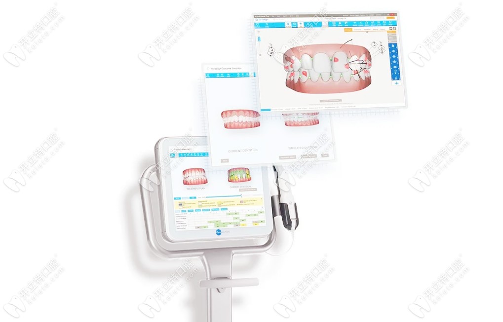 在嗎?帶你認(rèn)識(shí)下iTero可視化口掃，可預(yù)見矯正效果的那種！