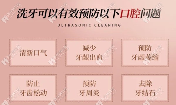 洗牙的優(yōu)點(diǎn)