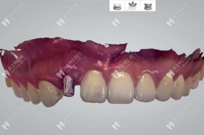 放入掃描桿并進行掃描