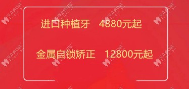曙光口腔發(fā)來韓國登騰種植牙4880元起優(yōu)惠價格，終于等到了