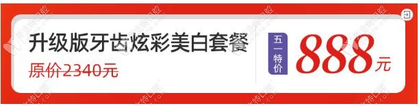 西安圣貝齒科牙齒美白價格