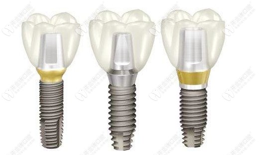 韓國登騰種植體的外觀