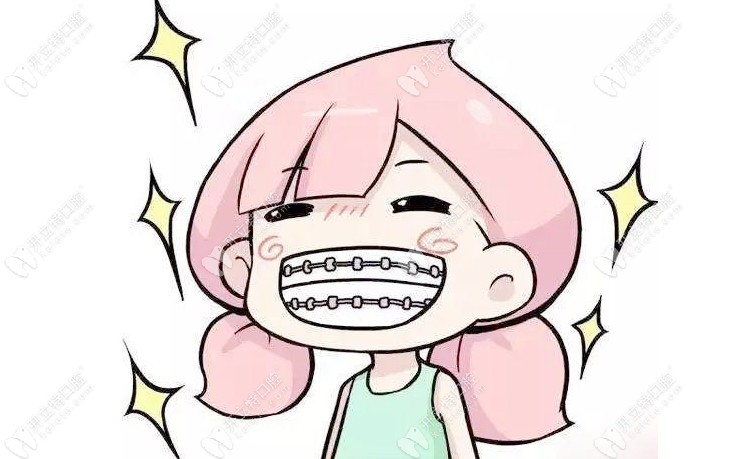 戴上牙套后的樣子