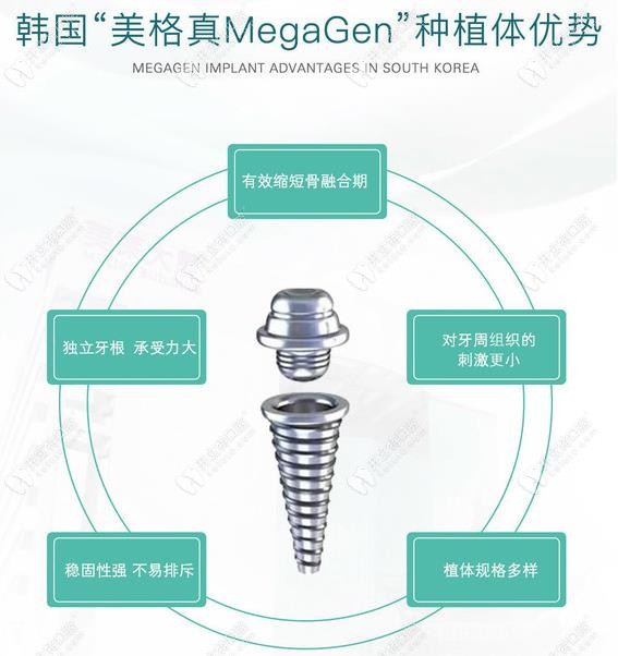 韓國(guó)美格真種植體的優(yōu)勢(shì)