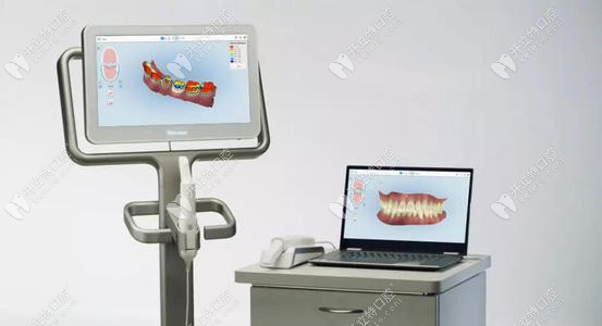 口掃設(shè)備實(shí)拍圖