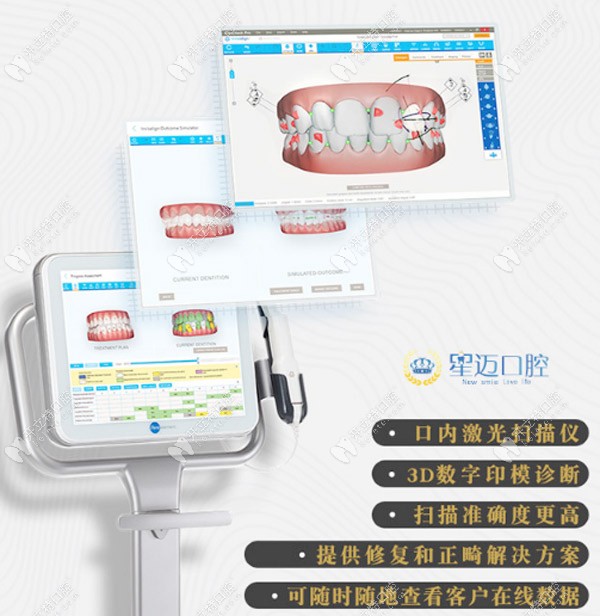 iTero口掃設(shè)備的特點(diǎn)