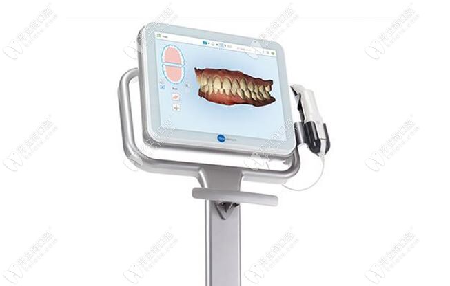 隱適美iTero口掃黑科技