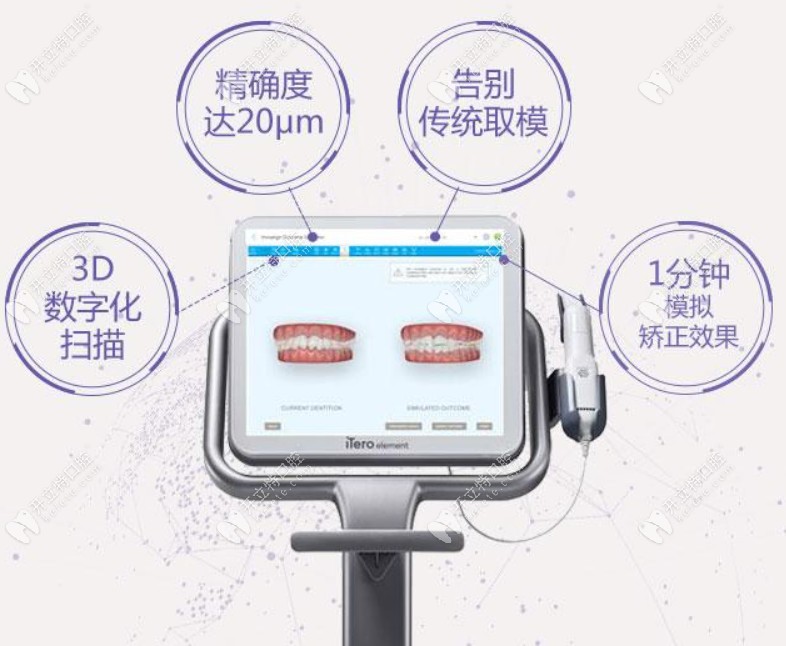廣大口腔iTero口掃設(shè)備特點(diǎn)