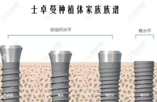 別只看價格,士卓曼種植體材料鈦鋯和純鈦區(qū)別不是一點點