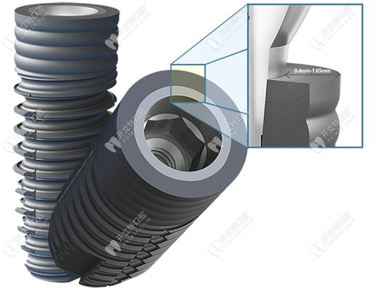 CLC種植體支持美學(xué)修復(fù)