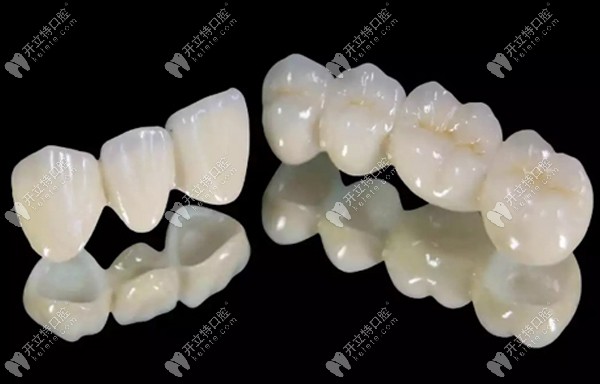 洋紫荊全瓷牙和威蘭德哪個(gè)好