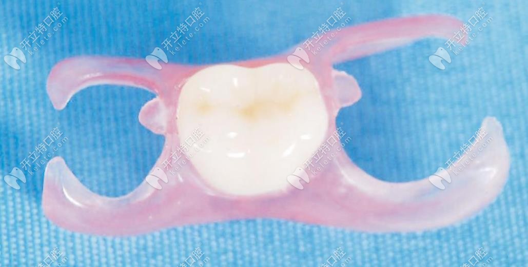 少一顆牙有幾種方法修復(fù),年輕人鑲活動(dòng)和固定假牙哪種好？