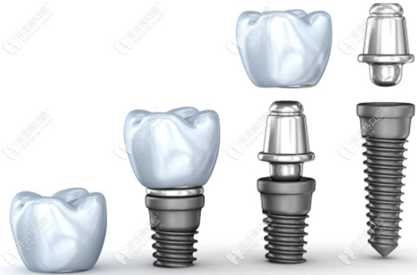 瑞士ITI較意大利BB價格高