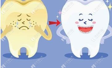 美國達妃琦牙齒美白怎么樣,和皓齒及冷光美白相比有啥區(qū)別